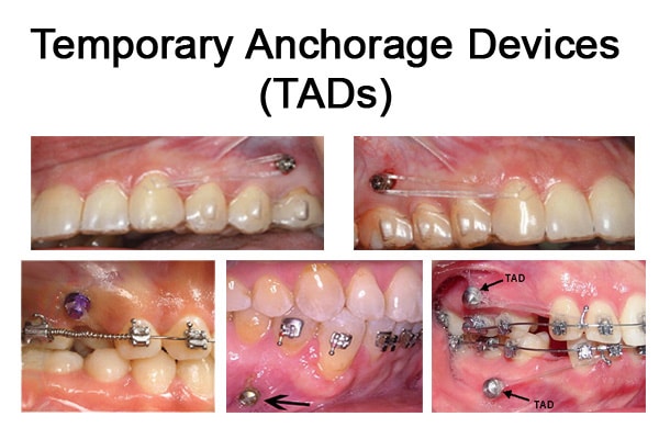 tads-copy